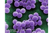 Khảo sát tỉ lệ nhiễm S. aureus và E. coli nhiễm trong các nhóm thực phẩm như thịt gia súc, các loại cá, thủy sản và các loại rau